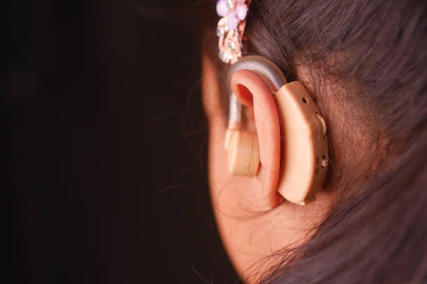 This is a close-up photograph of a person's ear with a hearing aid. The hearing aid is visible behind the ear and connected to the inner ear, highlighting an assistive technology used by people with hearing impairments.